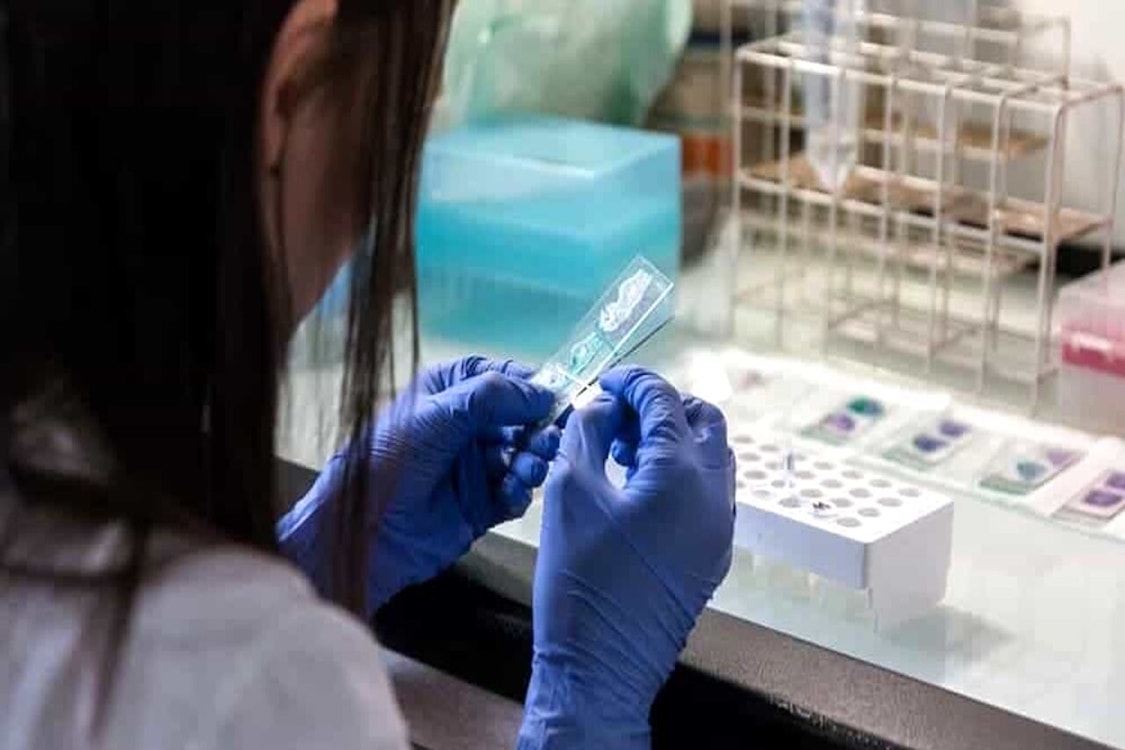 legionella laboratorio